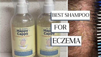 shampoo for eczema